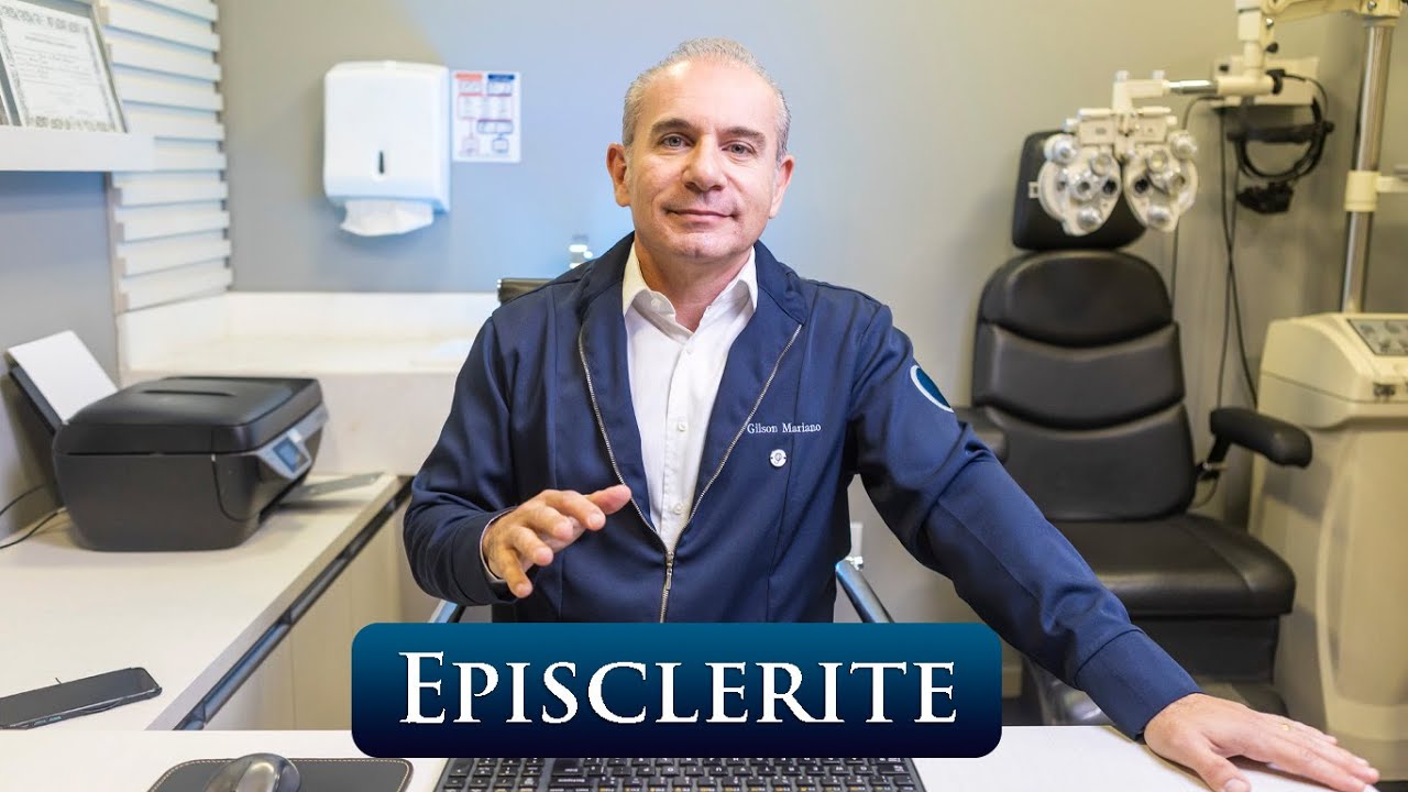 EPISCLERITE