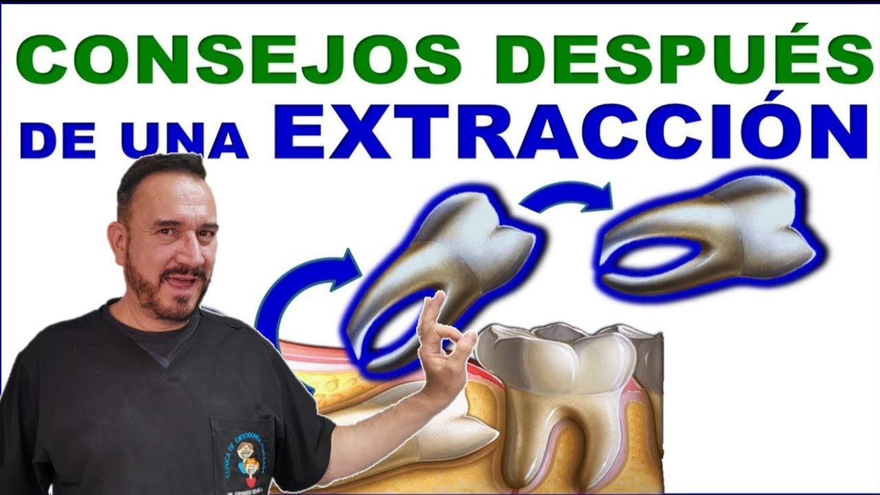 Что делать после удаления зуба? Простые советы