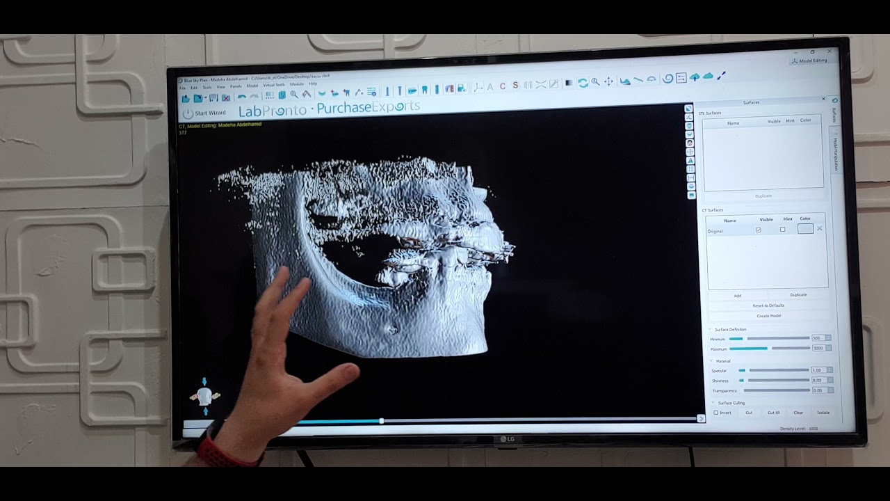 How to simply read CBCT? in Arabic