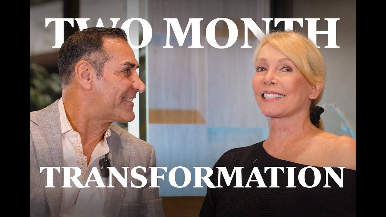 Preservation Deep Plane Face & Neck Lift Results