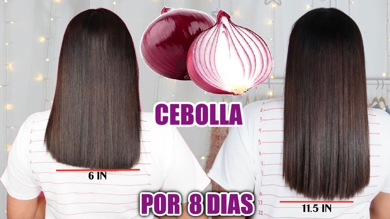 RETO#3 CEBOLLA PARA HACER CRECER EL CABELLO Y DETENER LA CAIDA  EN  8 DIAS 🧅