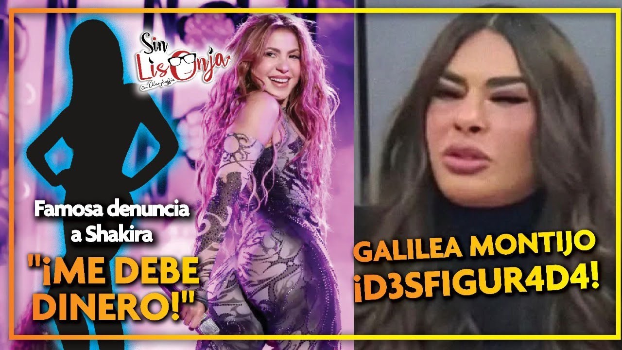¿QUÉ TE PASÓ EN LA CARA, GALILEA MONTIJO?