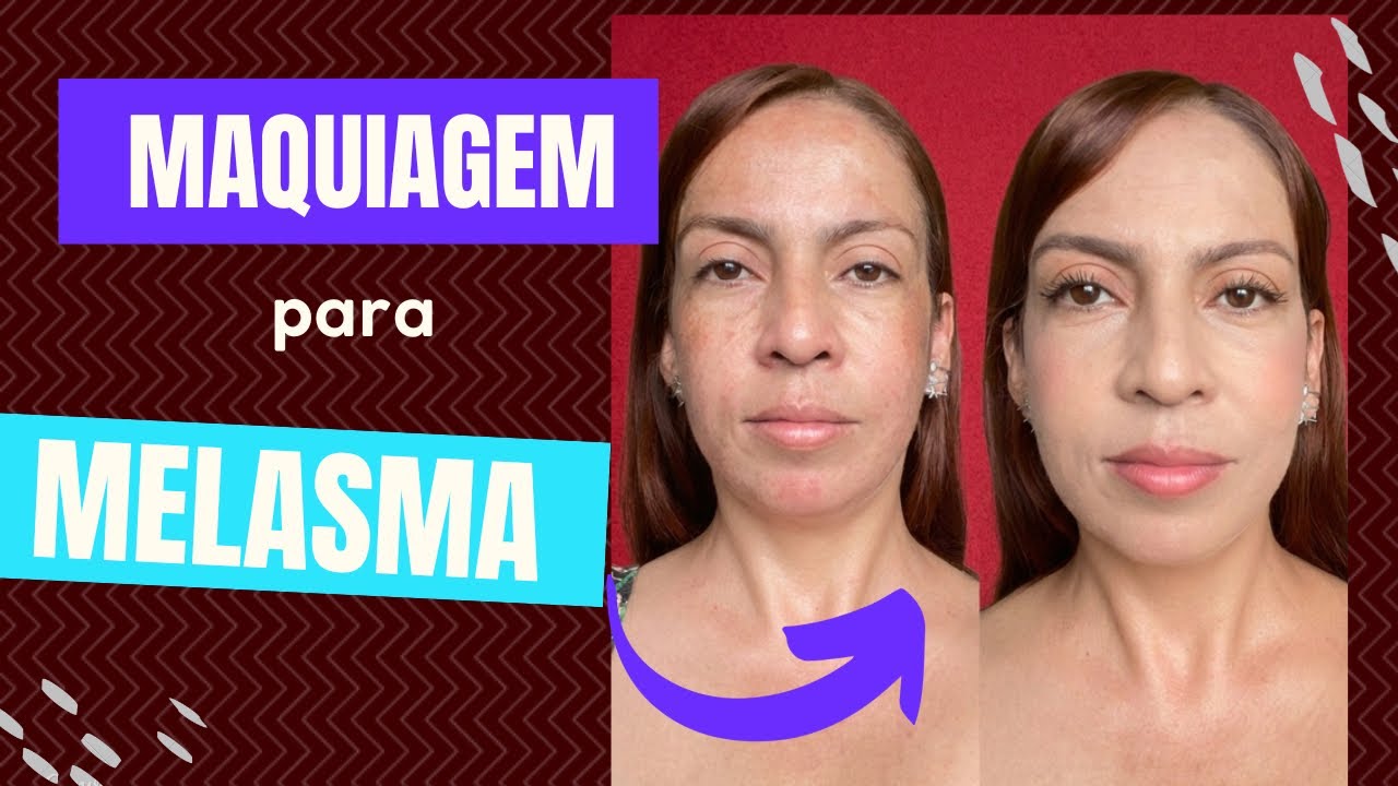 Pele uniforme em minutos: cobrindo melasma sem pesar