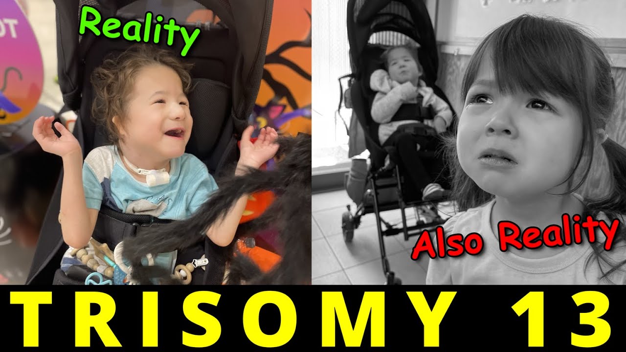 The Reality of Being a Trisomy Parent (TRISOMY 13 / PATAU SYNDROME)