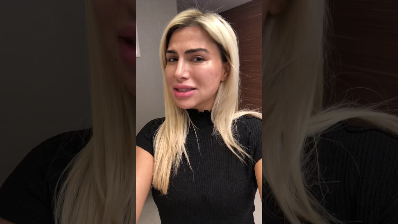 Doktor Sevinc Heydərovanın kök hüceyrə üz cavanlaşma proseduru təcrübəsi