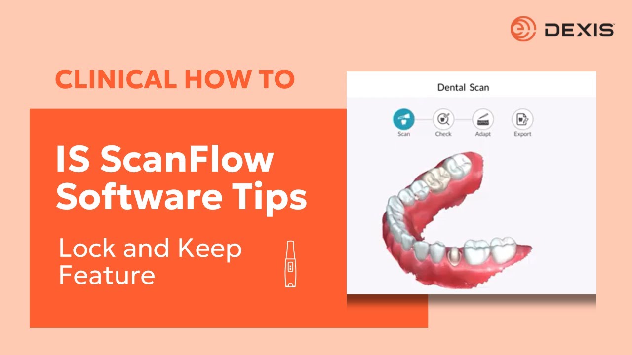 DEXIS&trade; IS ScanFlow - Using the Lock and Keep Tools for Intraoral Scanners
