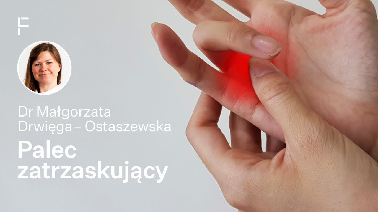 Palec zatrzaskujący – przyczyny, objawy, leczenie i powrót do sprawności