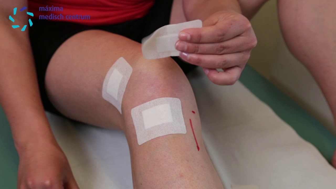 MMC fysiotherapie jongeren 06: verband verwijderen en pleisters plakken