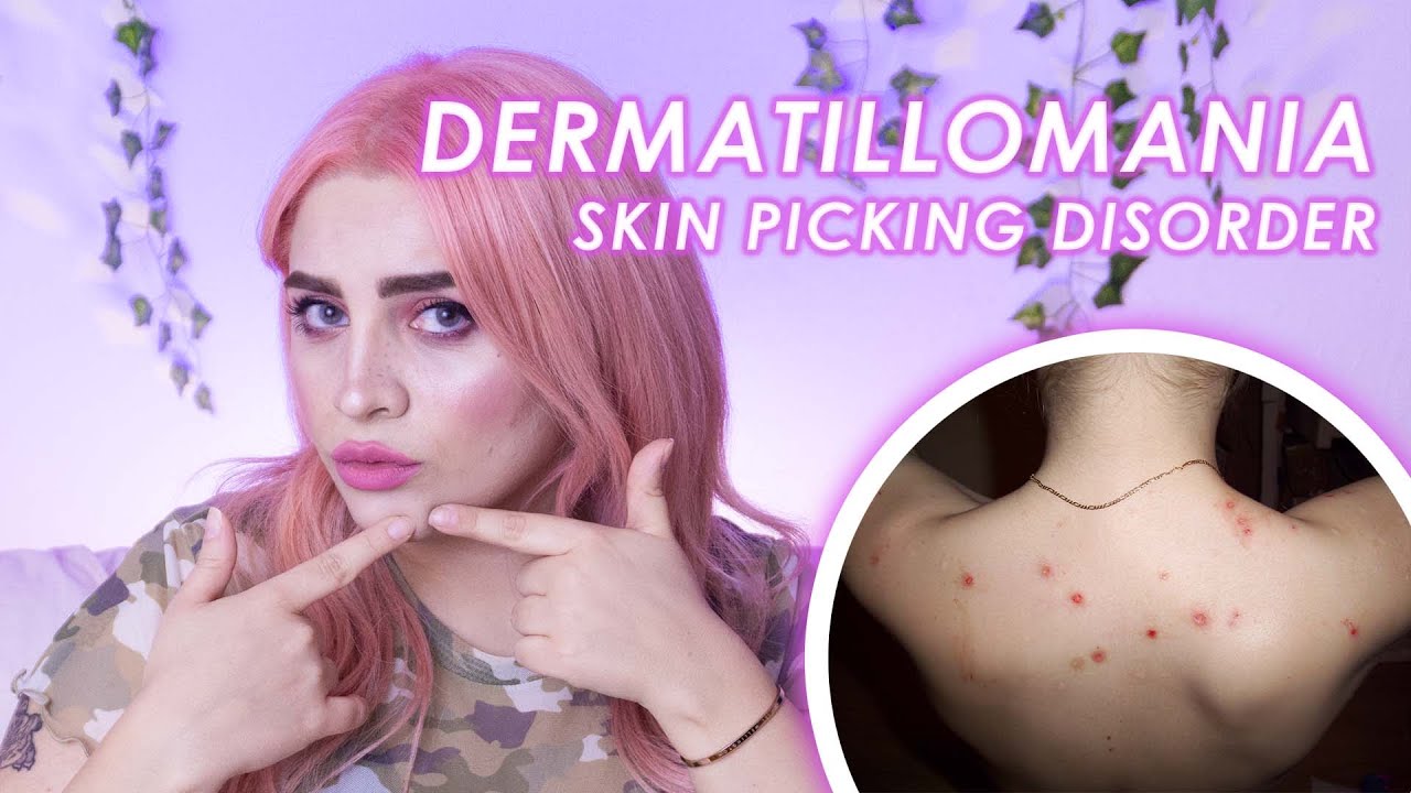 DERMATILLOMANIA: cos’è e come uscirne