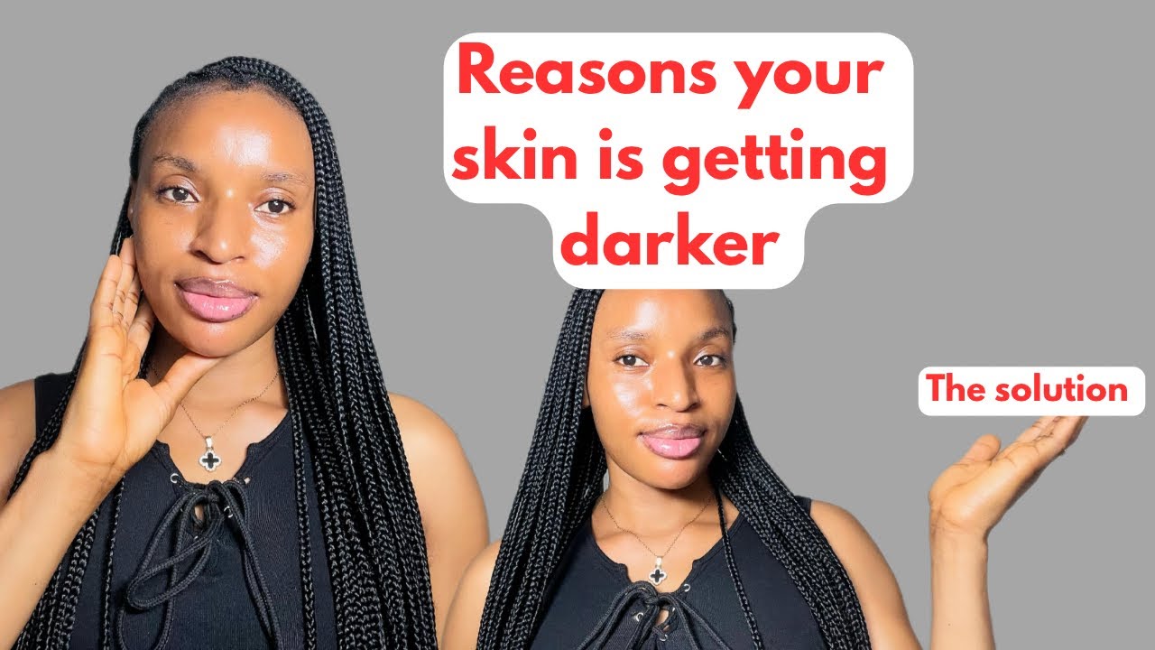 Why Your Skin Is Getting Darker — How to fix it