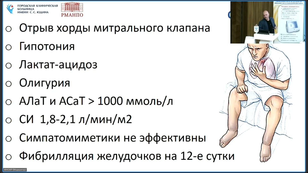 18.11.2025 Измерение сердечного выброса в различных клинических ситуациях.