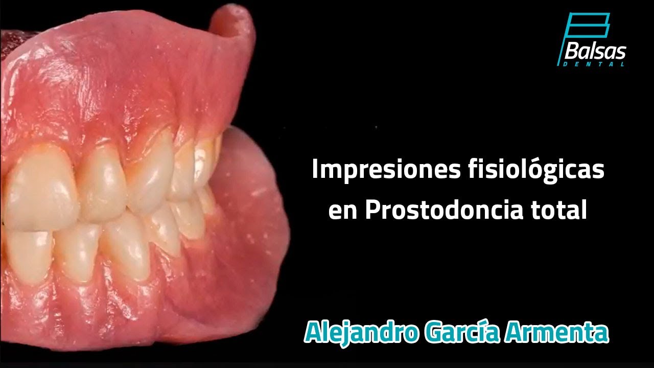 Impresiones Fisiológicas en Prostodoncia Total. Alejandro  García Armenta