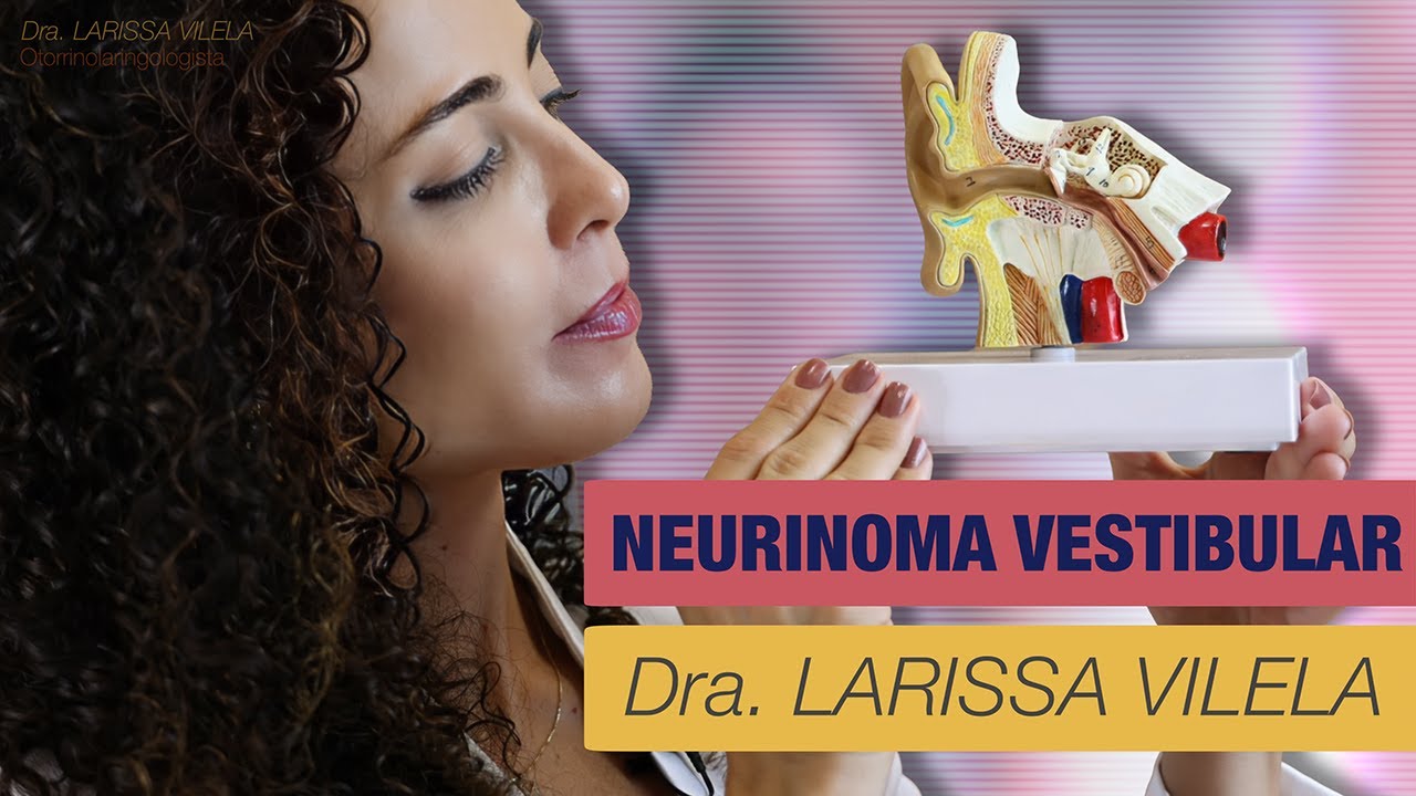 Neurinoma vestibular (schwannoma): o que é, causas, diagnóstico, tratamento e surdez unilateral.