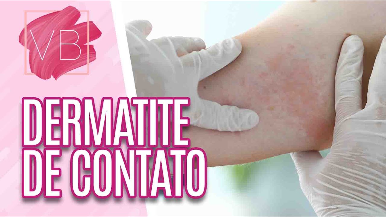 Saiba quais as causas da dermatite de contato - Você Bonita (11/08/21)
