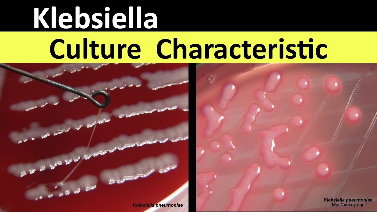 Culture Characteristic Of Klebsiella