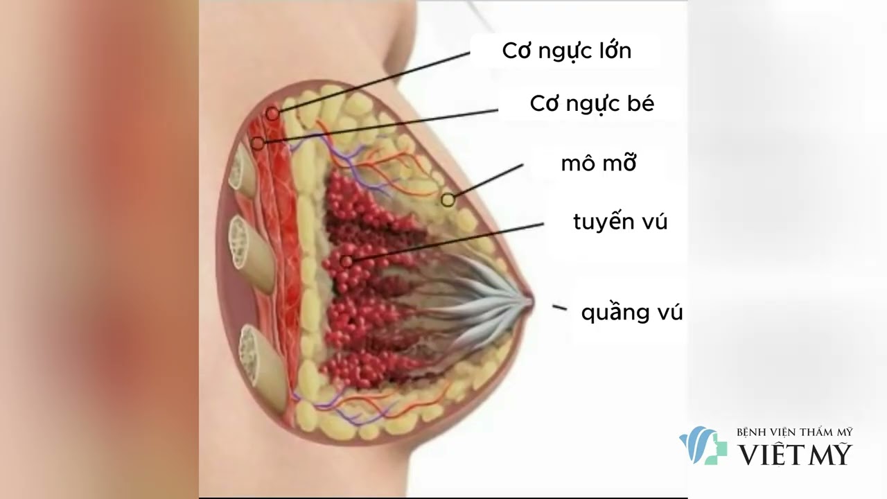 Video mô phỏng nâng ngực 3D – Phẫu thuật nâng ngực quanh quầng vú an toàn và hiệu quả