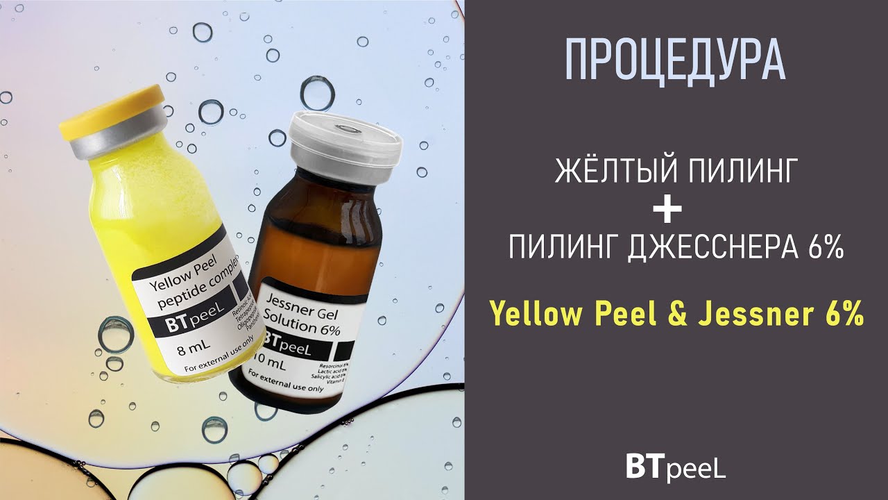 Процедура Жёлтый пилинг + Пилинг Джесснера 6%