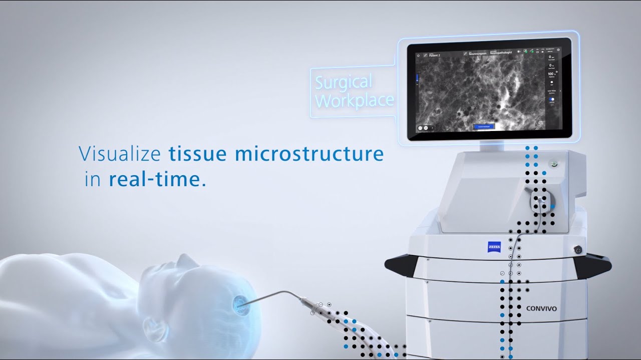 Introducing ZEISS CONVIVO - In Vivo Pathology Suite