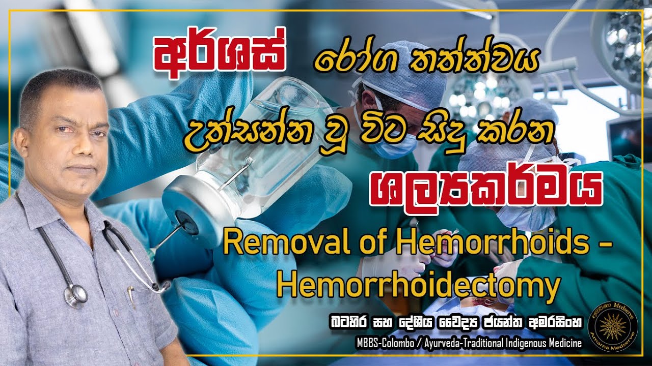 අර්ශස්  රෝගී තත්ත්වය උත්සන්න වූ විට සිදු කරන ශල්‍යකර්මය | Removal of Hemorrhoid - Hemorrhoidectomy