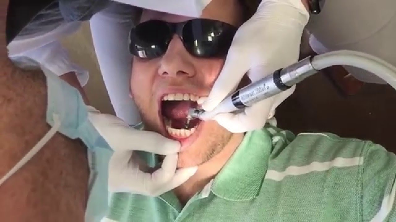 JEFF GETS HIS BRACES OFF!