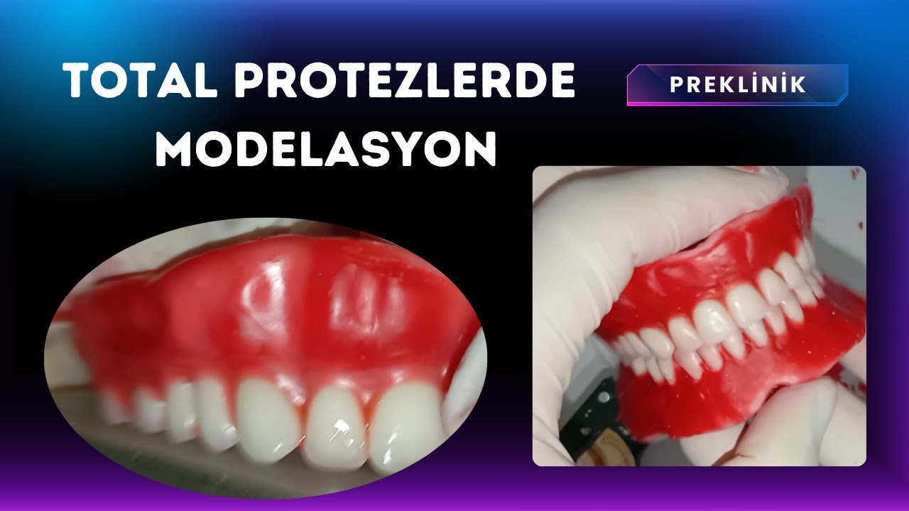 Total Protezlerde Modelasyon