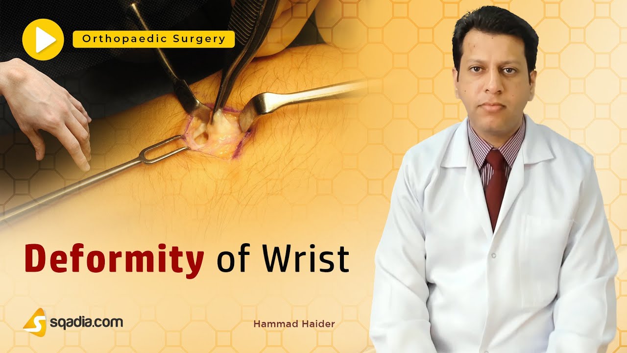 Deformity of Wrist | Orthopedic Surgery Tutorials | Clinical V-Learning | sqadia.com