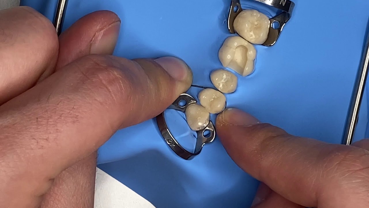 Master the Art of Posterior Dental Isolation: Rubber Dam Inversion!