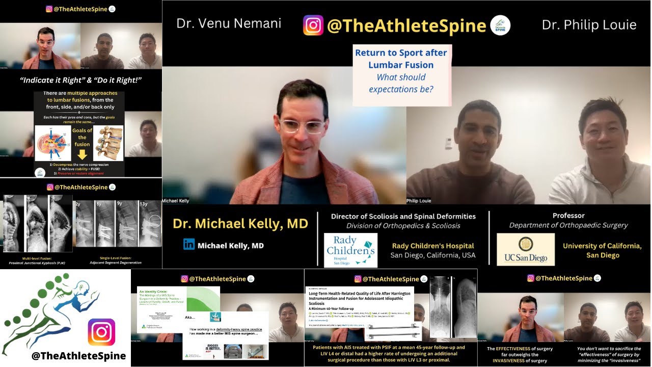 Return To Play After Lumbar Fusion? What should our expectations be? | Guest: Dr. Michael Kelly, MD