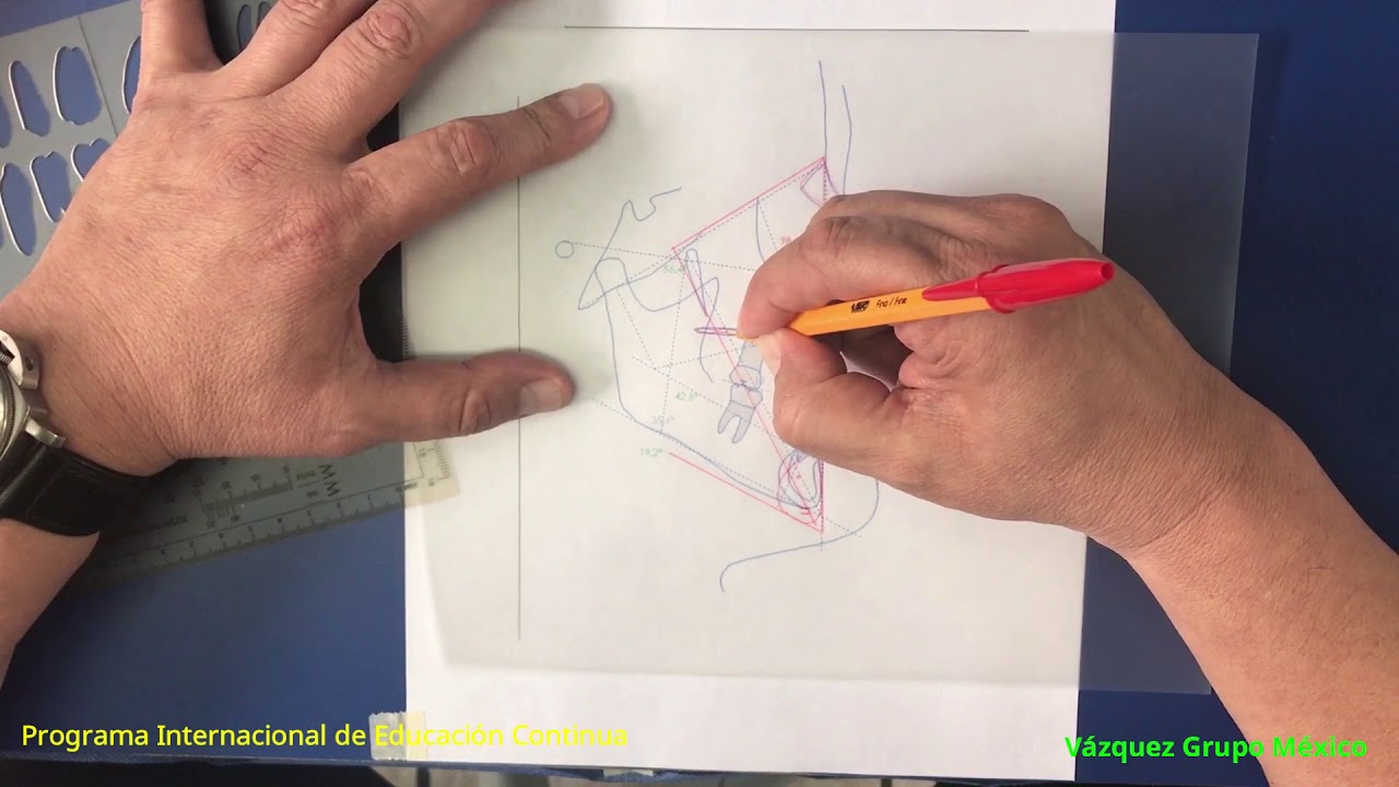 VTO con crecimiento.  Manuel Vázquez Uribe
