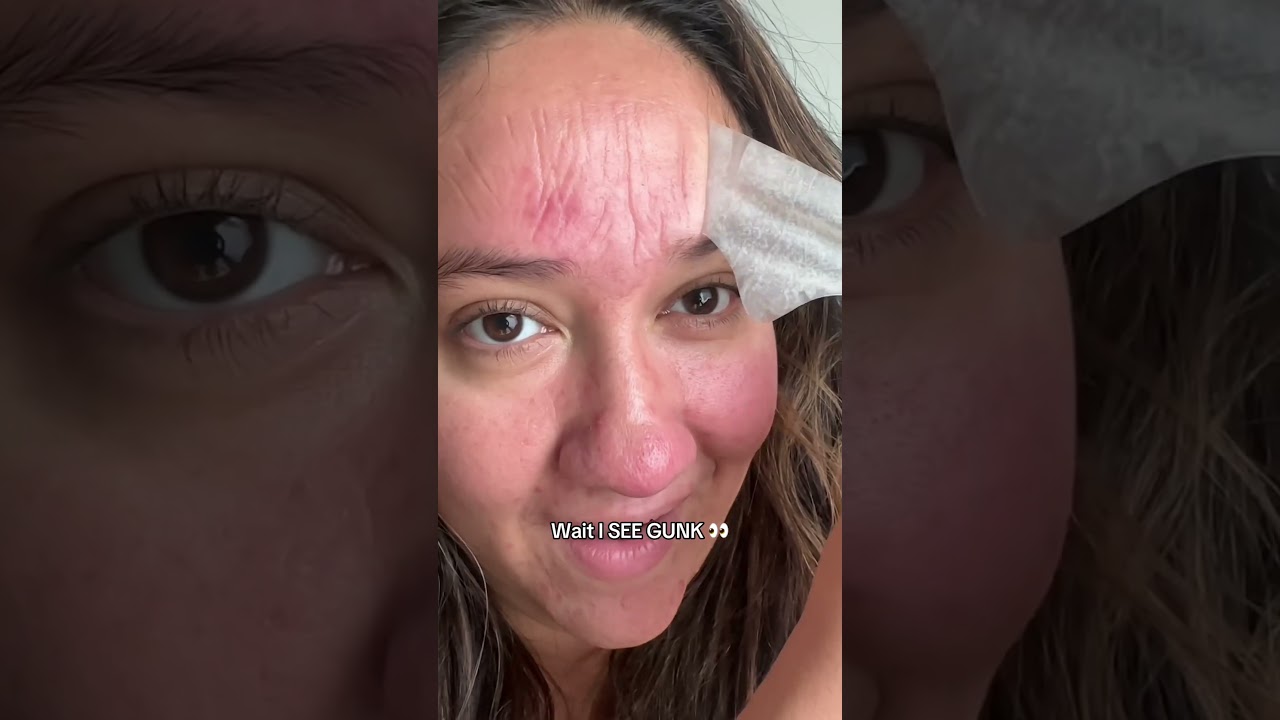 Does Hero&rsquo;s Mighty Patch&trade; Forehead patch REALLY WORK??