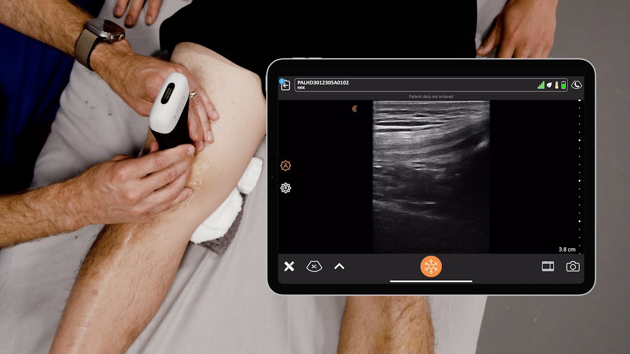 POCUS for Knee Joint