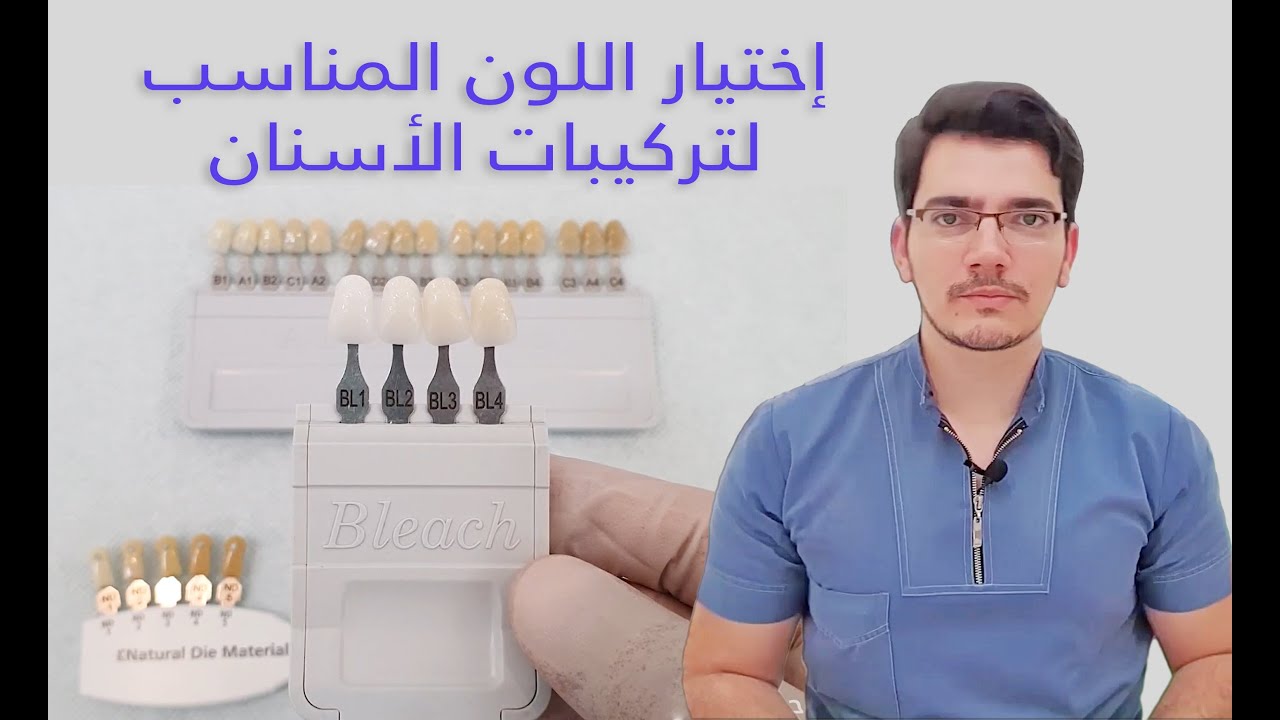 اختيار اللون المناسب لتركيبات الاسنان