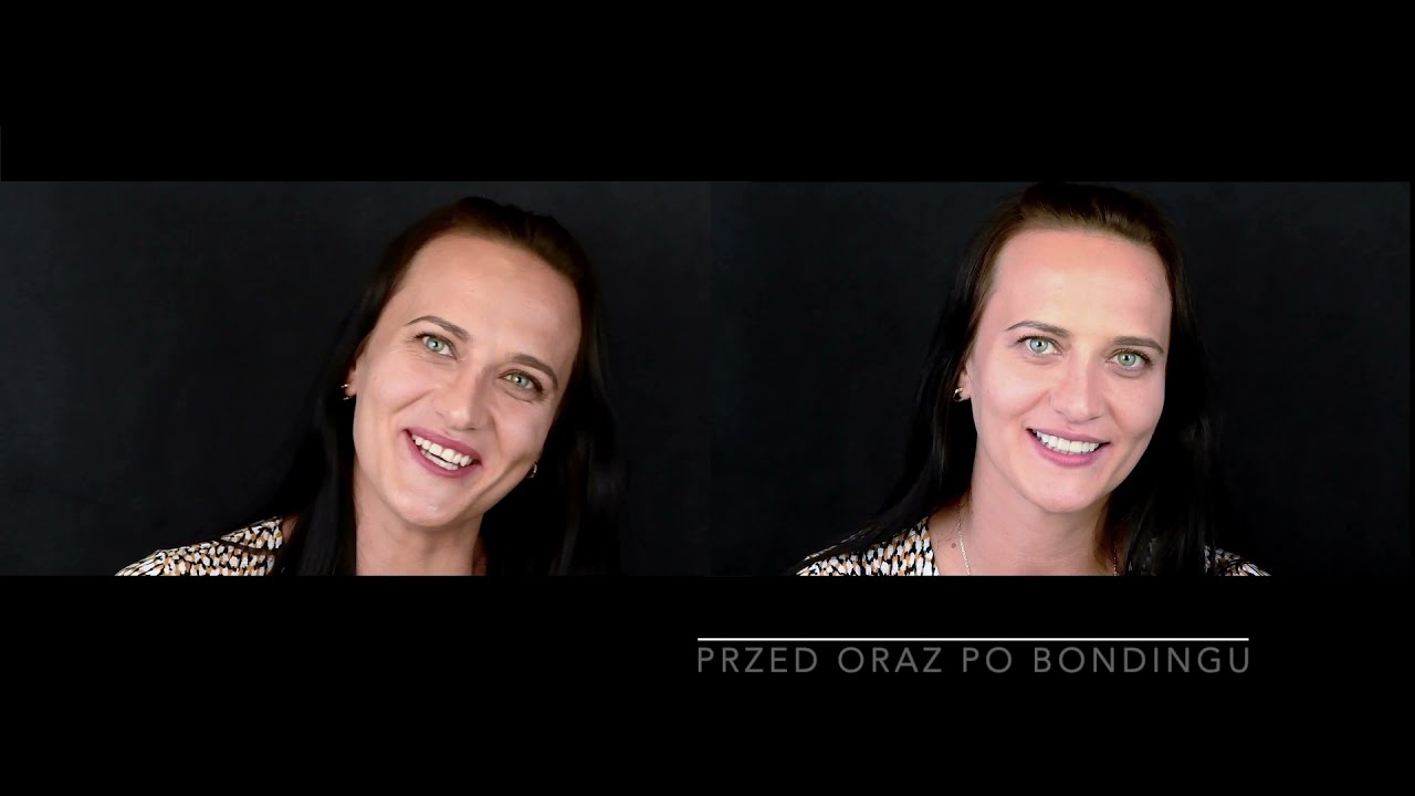 Metamorfoza metodą Flow Injection