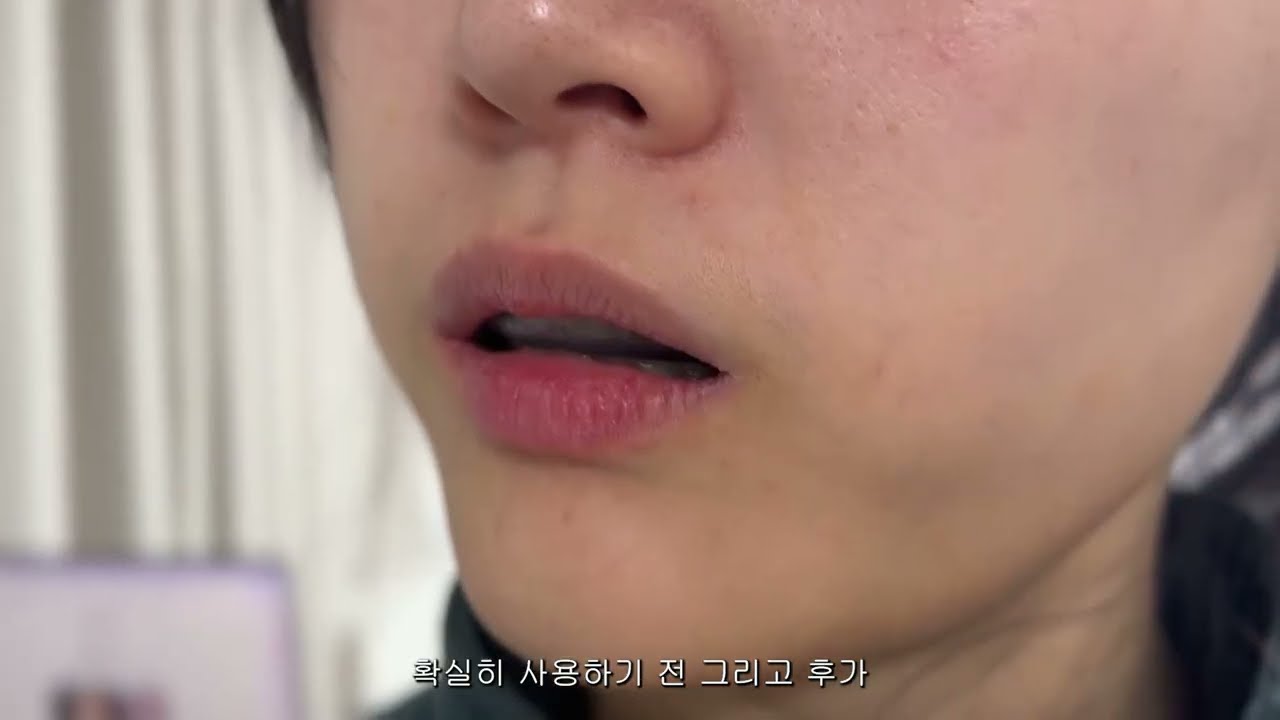 링클백 페이스핏 가이드 팔자주림관리엔 팔자주름링클팩