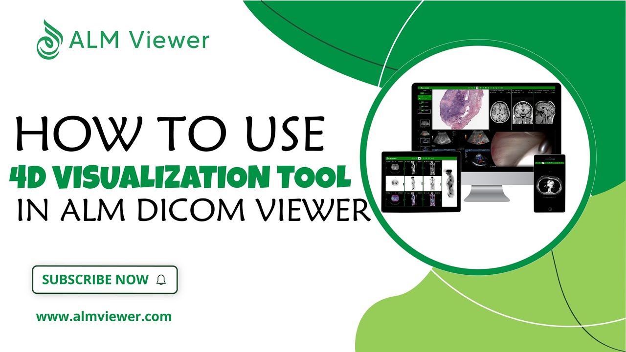 How to Use 4D Visualization in ALM Dicom Viewer | By Alm Viewer