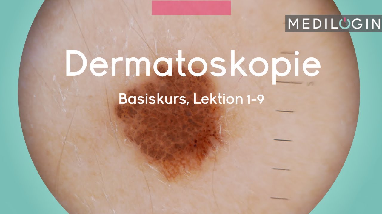 Dermatoskopie (Basiskurs) | MEDILOGIN