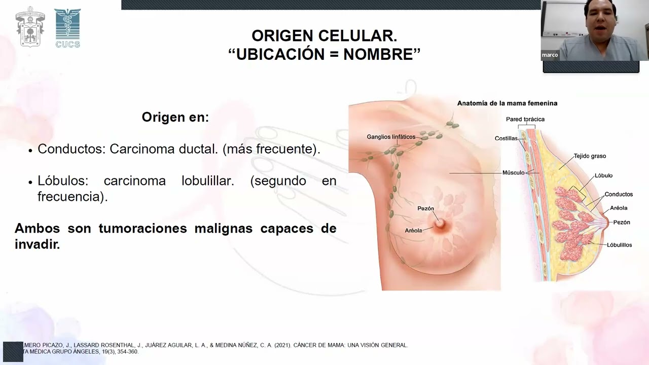 Cáncer de mama Fundamentos Clínicos de Enfermería