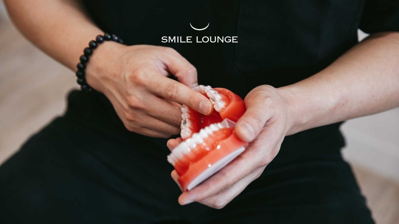 Braces vs Angel Aligners?
