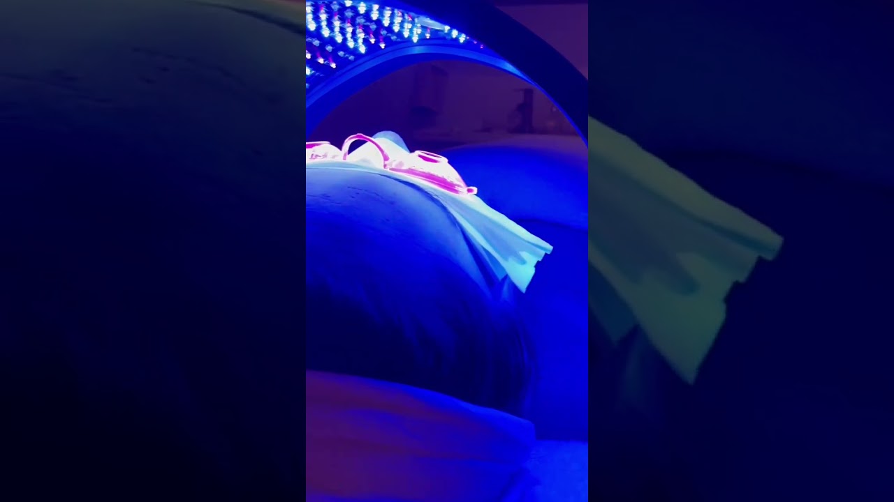Custom deep pore cleansing facial w/ blue light therapy @BioTherapeutic @BioPhotas @iSCLINICAL