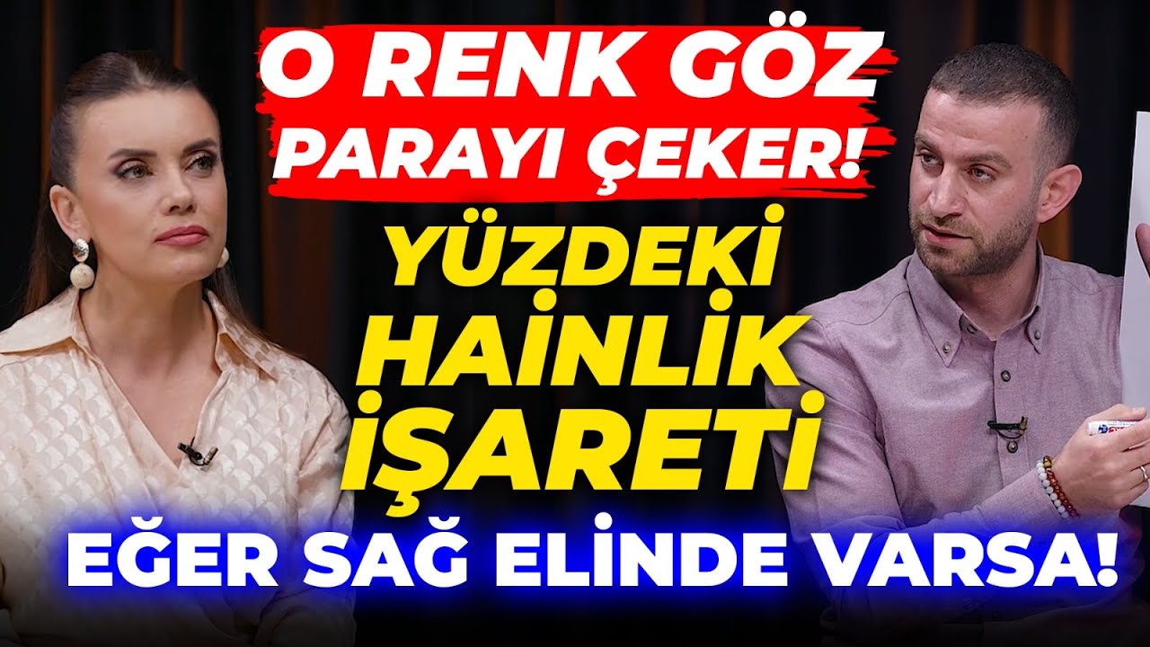 O Y&Uuml;Z TİPİNDEN KORKUN! Bu &Uuml;&ccedil; Şey Asla Değişmez! Elinde O Noktada Şişkinlik Varsa Zengin Olursun