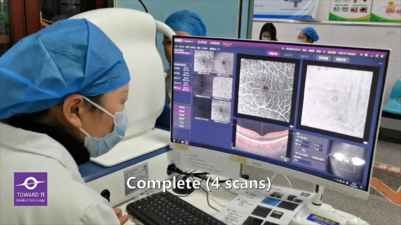 Work flow of TowardPi SS-OCT in daily practice, Model: Yalkaid (100KHz), 4 scans in 2 minutes, Uncut