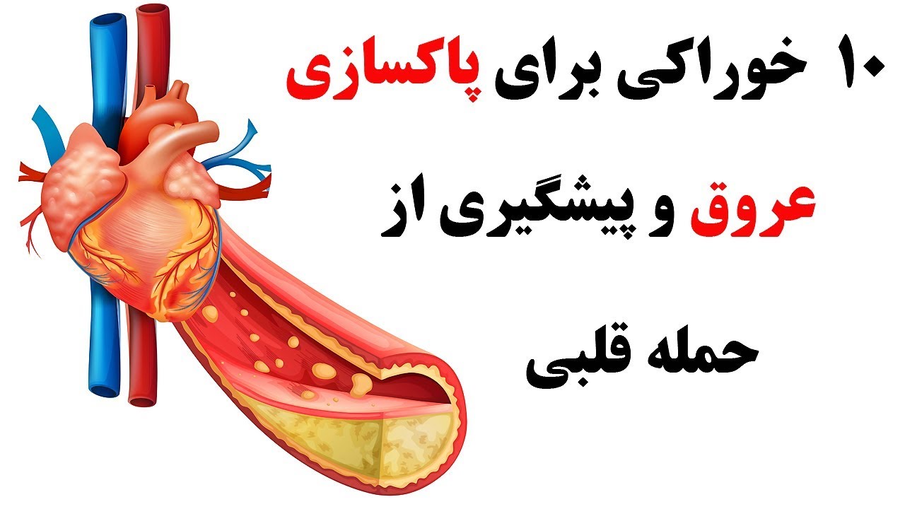 ده ماده خوراکی برای  پاکسازی عروق و پیشگیری از حمله قلبی