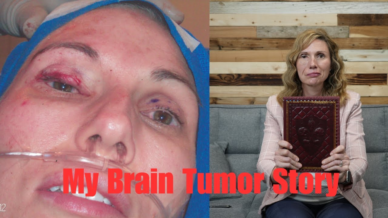My Brain Tumor Story: What are the lingering symptoms after the removal of a tumor