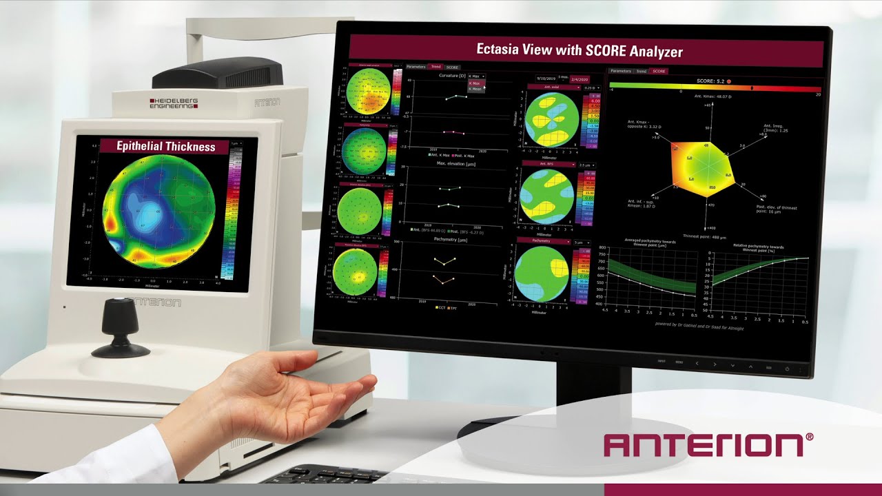 New clinical features | ANTERION