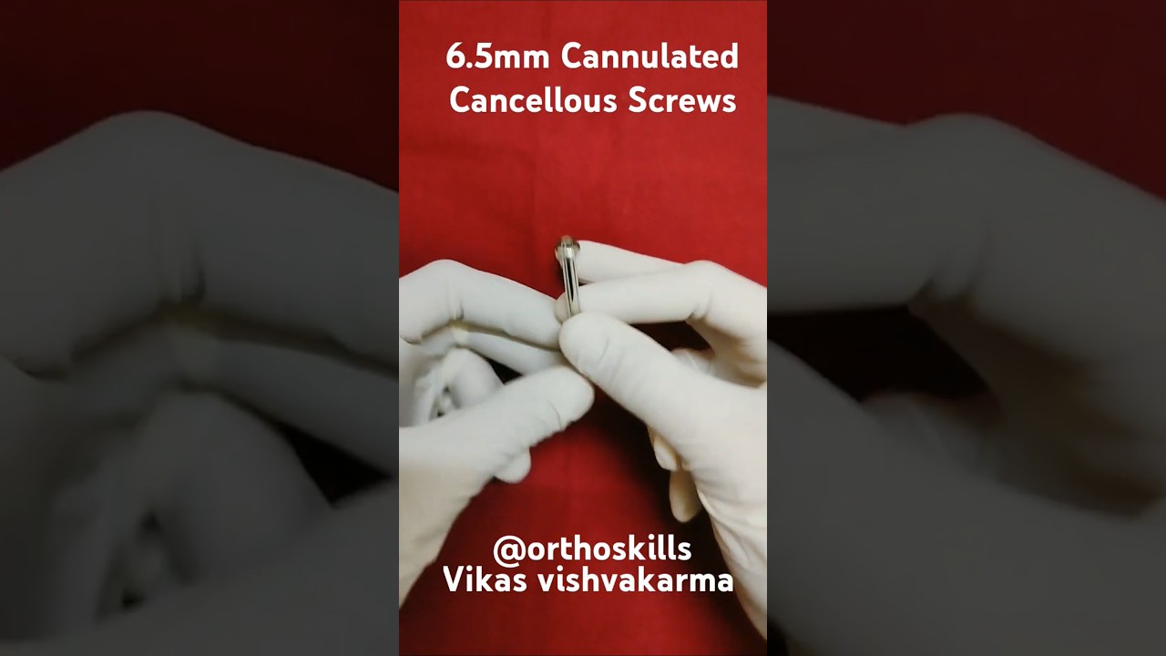 6.5 mm Cannulated Cancellous Screws.c.c screw .6.0 mm Cannulated Screw.Bone screw.