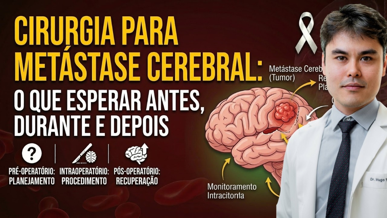 Cirurgia para Metástase Cerebral: O Que Esperar Antes, Durante e Depois