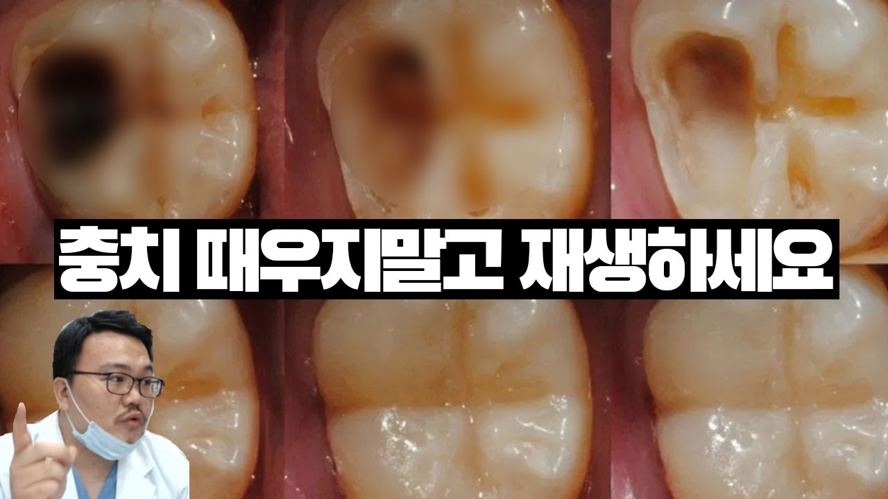 17년차 치과의사가 알려주는 치아재생 기술의 현주소.