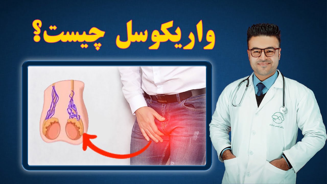 واریکوسل چیست؟| داکتر قیس نیکزاد