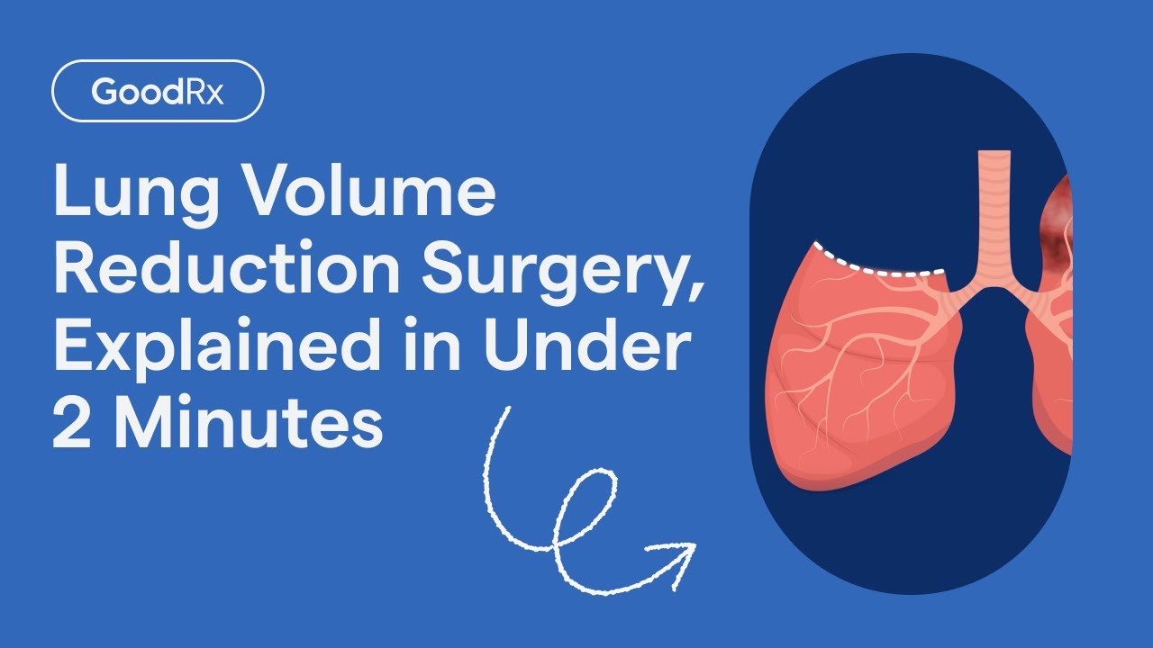 What Is Lung Volume Reduction Surgery and How Does It Work? | GoodRx