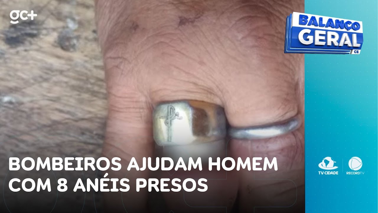 Bombeiros ajudam homem com 8 anéis presos nos dedos inchado | Balanço Geral CE